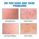 Feuchtigkeitsspendendes und reparierendes Hautpflegewasser