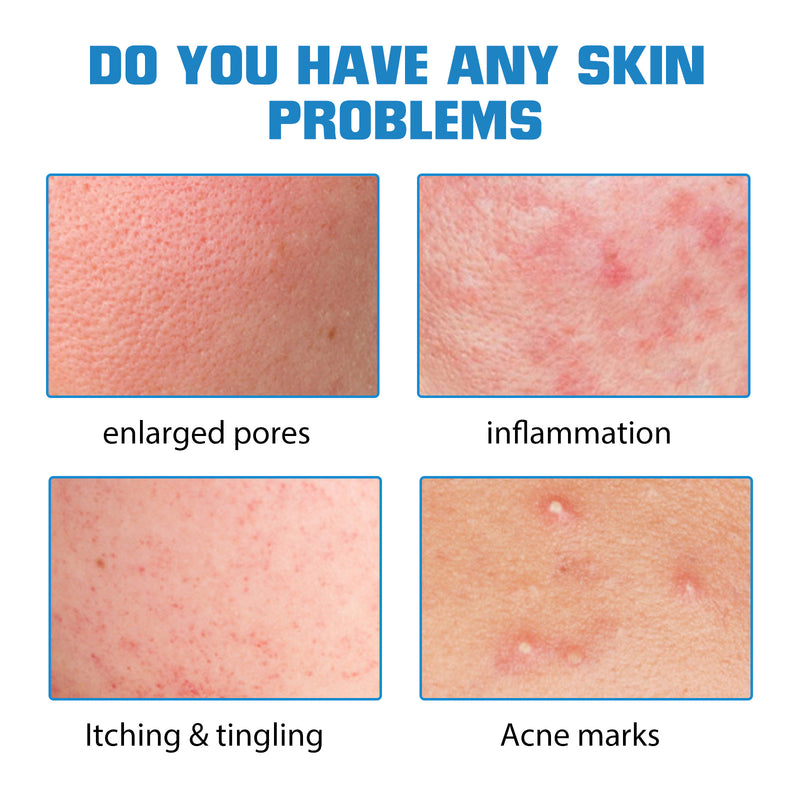 Feuchtigkeitsspendendes und reparierendes Hautpflegewasser